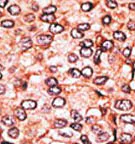 Immunohistochemistry (Formalin/PFA-fixed paraffin-embedded sections) - Anti-MAGEA2 antibody - Aminoterminal end (AB71786)