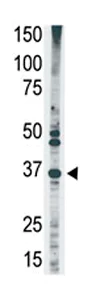 Western blot - Anti-MAGEA2 antibody - Aminoterminal end (AB71786)