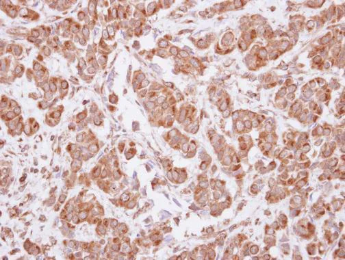 Immunohistochemistry (Formalin/PFA-fixed paraffin-embedded sections) - Anti-MAGEA4 antibody (AB229011)