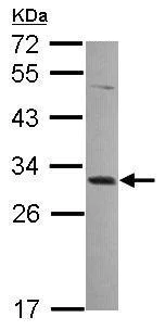 Western blot - Anti-MAGEA4 antibody (AB229011)