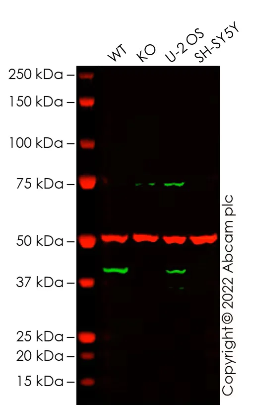 Western blot - Anti-MAGEA4 antibody (AB229011)