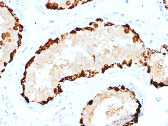Immunohistochemistry (Formalin/PFA-fixed paraffin-embedded sections) - Anti-MAGEA4 antibody [CPTC-MAGEA4-1] - BSA and Azide free (AB268201)