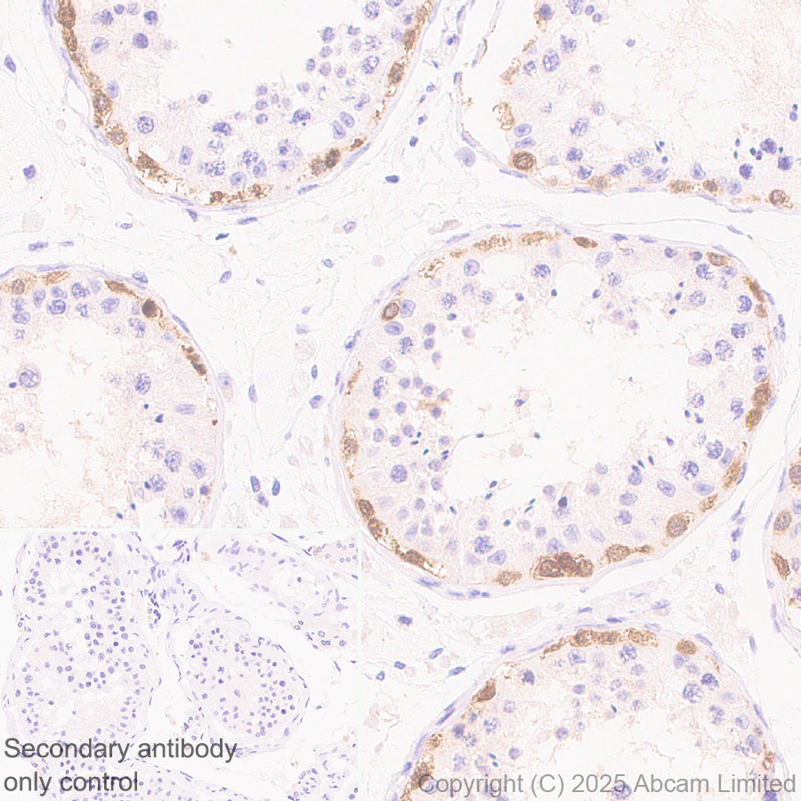 Immunohistochemistry (Formalin/PFA-fixed paraffin-embedded sections) - Anti-MAGEA4 antibody [EPR26098-164] - BSA and Azide free (AB323811), expandable thumbnail