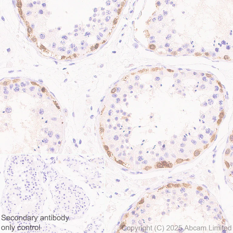 Immunohistochemistry (Formalin/PFA-fixed paraffin-embedded sections) - Anti-MAGEA4 antibody [EPR26098-164] - BSA and Azide free (AB323811)