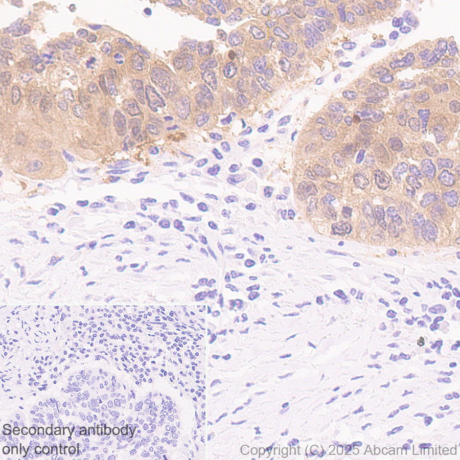 Immunohistochemistry (Formalin/PFA-fixed paraffin-embedded sections) - Anti-MAGEA4 antibody [EPR26098-164] - BSA and Azide free (AB323811), expandable thumbnail