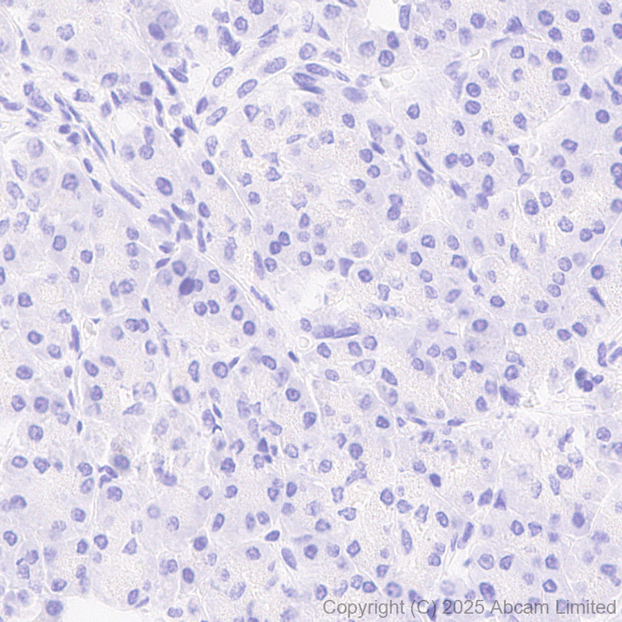 Immunohistochemistry (Formalin/PFA-fixed paraffin-embedded sections) - Anti-MAGEA4 antibody [EPR26098-164] - BSA and Azide free (AB323811), expandable thumbnail