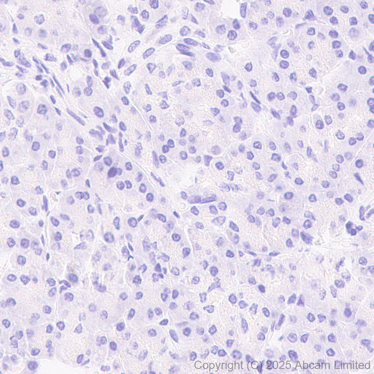 Immunohistochemistry (Formalin/PFA-fixed paraffin-embedded sections) - Anti-MAGEA4 antibody [EPR26098-164] - BSA and Azide free (AB323811)