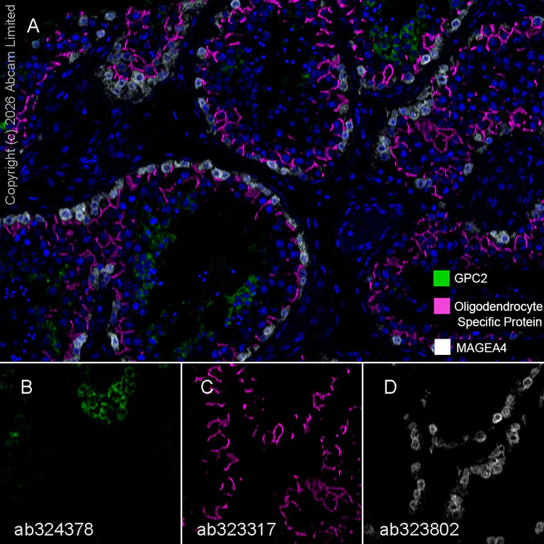 Multiplex immunohistochemistry - Anti-MAGEA4 antibody [EPR26098-164] - BSA and Azide free (AB323811)