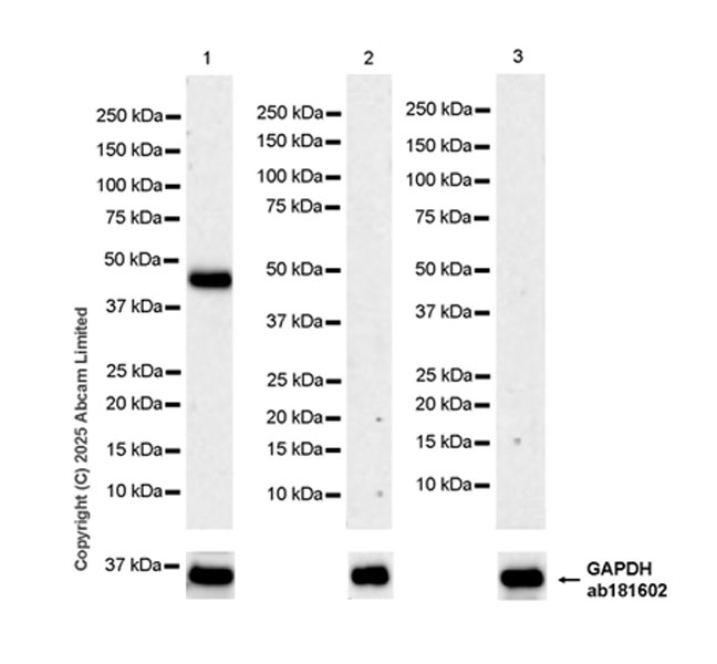 Western blot - Anti-MAGEA4 antibody [EPR26098-164] - BSA and Azide free (ab323811), expandable thumbnail