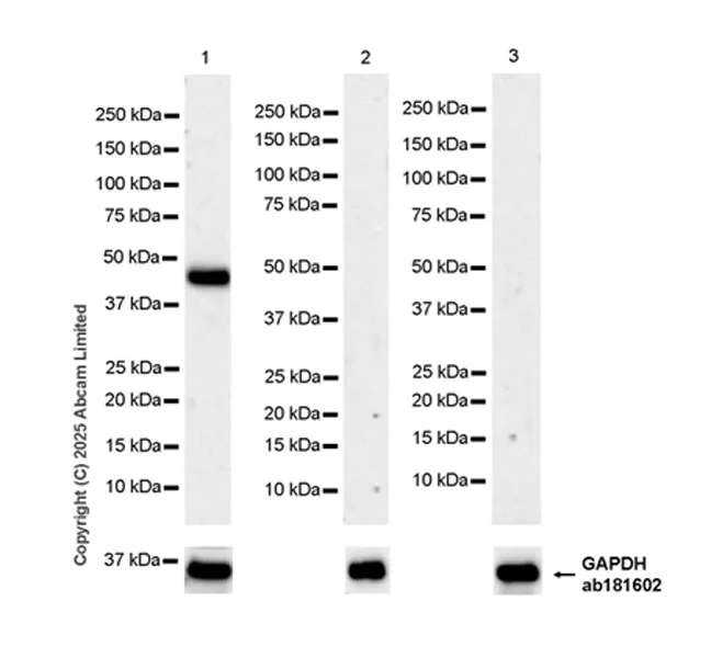 Western blot - Anti-MAGEA4 antibody [EPR26098-164] - BSA and Azide free (AB323811)