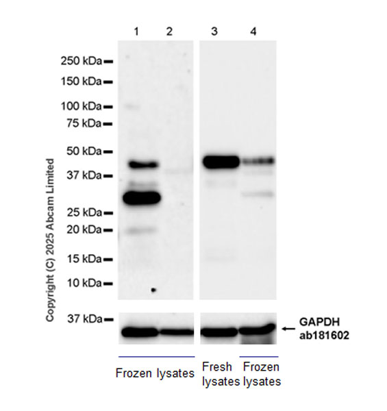 Western blot - Anti-MAGEA4 antibody [EPR26098-164] - BSA and Azide free (AB323811), expandable thumbnail