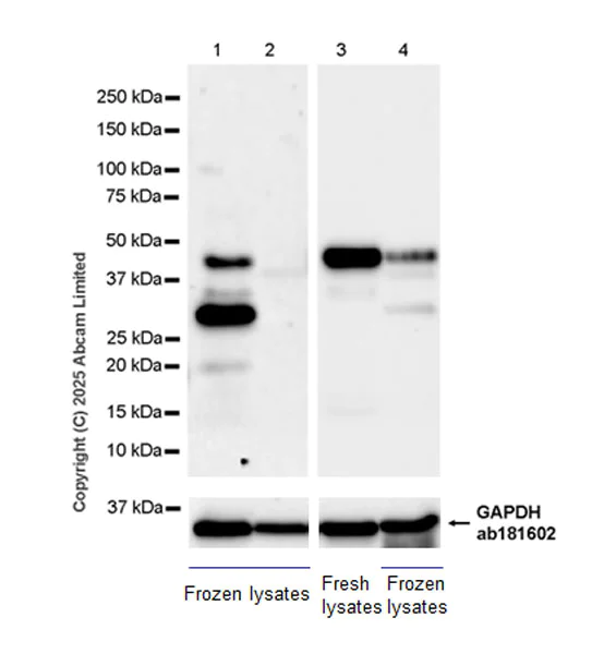 Western blot - Anti-MAGEA4 antibody [EPR26098-164] - BSA and Azide free (AB323811)