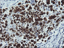 Immunohistochemistry (Formalin/PFA-fixed paraffin-embedded sections) - Anti-MAGEA4 antibody [OTI1F9] (AB139297), expandable thumbnail
