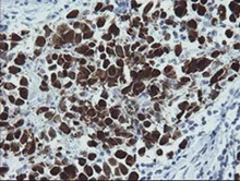 Immunohistochemistry (Formalin/PFA-fixed paraffin-embedded sections) - Anti-MAGEA4 antibody [OTI1F9] (AB139297)
