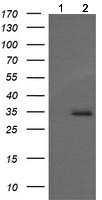 Western blot - Anti-MAGEA4 antibody [OTI1F9] (AB139297), expandable thumbnail