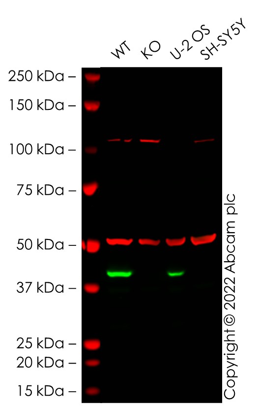 Western blot - Anti-MAGEA4 antibody [OTI1F9] (AB139297), expandable thumbnail