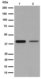 Western blot - Anti-MAGEA9 antibody [EPR16258] (AB191568)
