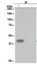 Immunoprecipitation - Anti-MAGEA9 antibody [EPR16258] - BSA and Azide free (AB251089)