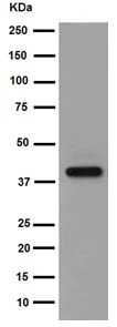 Western blot - Anti-MAGEA9 antibody [EPR16258] - BSA and Azide free (AB251089)