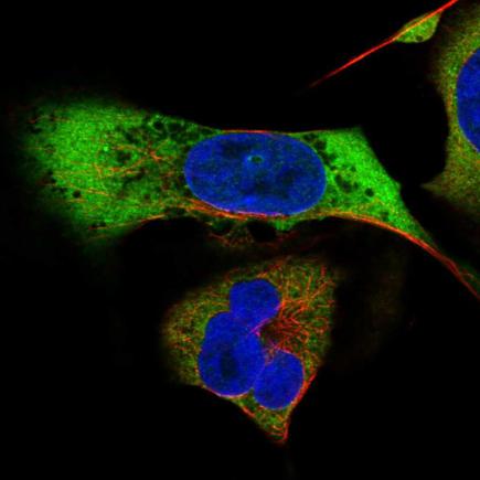 Immunocytochemistry/ Immunofluorescence - Anti-MAGEB2 antibody (AB221559), expandable thumbnail