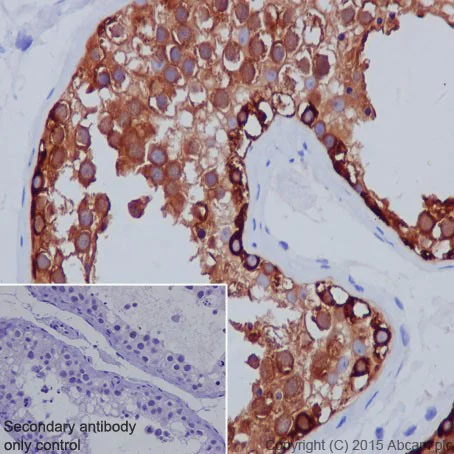 Immunohistochemistry (Formalin/PFA-fixed paraffin-embedded sections) - Anti-MAGEC1 antibody [EPR18067] - BSA and Azide free (AB251470)