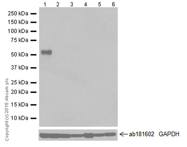 Western blot - Anti-MAGEC2 antibody [EPR19064] (AB209667)