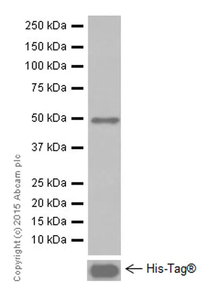 Western blot - Anti-MAGEC2 antibody [EPR19064] (AB209667)