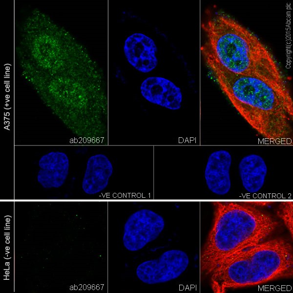 Immunocytochemistry/ Immunofluorescence - Anti-MAGEC2 antibody [EPR19064] - BSA and Azide free (AB223794), expandable thumbnail