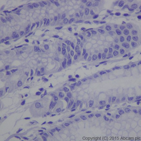Immunohistochemistry (Formalin/PFA-fixed paraffin-embedded sections) - Anti-MAGEC2 antibody [EPR19064] - BSA and Azide free (AB223794), expandable thumbnail