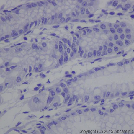Immunohistochemistry (Formalin/PFA-fixed paraffin-embedded sections) - Anti-MAGEC2 antibody [EPR19064] - BSA and Azide free (AB223794)