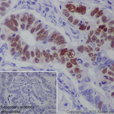 Immunohistochemistry (Formalin/PFA-fixed paraffin-embedded sections) - Anti-MAGEC2 antibody [EPR19064] - BSA and Azide free (AB223794)