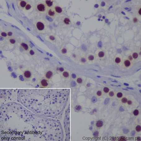 Immunohistochemistry (Formalin/PFA-fixed paraffin-embedded sections) - Anti-MAGEC2 antibody [EPR19064] - BSA and Azide free (AB223794), expandable thumbnail