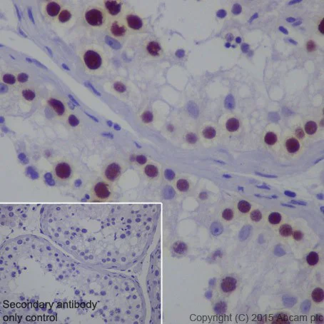 Immunohistochemistry (Formalin/PFA-fixed paraffin-embedded sections) - Anti-MAGEC2 antibody [EPR19064] - BSA and Azide free (AB223794)