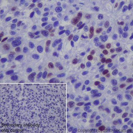 Immunohistochemistry (Formalin/PFA-fixed paraffin-embedded sections) - Anti-MAGEC2 antibody [EPR19064] - BSA and Azide free (ab223794), expandable thumbnail