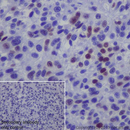 Immunohistochemistry (Formalin/PFA-fixed paraffin-embedded sections) - Anti-MAGEC2 antibody [EPR19064] - BSA and Azide free (AB223794)