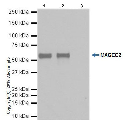 Immunoprecipitation - Anti-MAGEC2 antibody [EPR19064] - BSA and Azide free (AB223794), expandable thumbnail