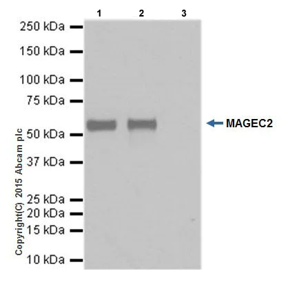 Immunoprecipitation - Anti-MAGEC2 antibody [EPR19064] - BSA and Azide free (AB223794)