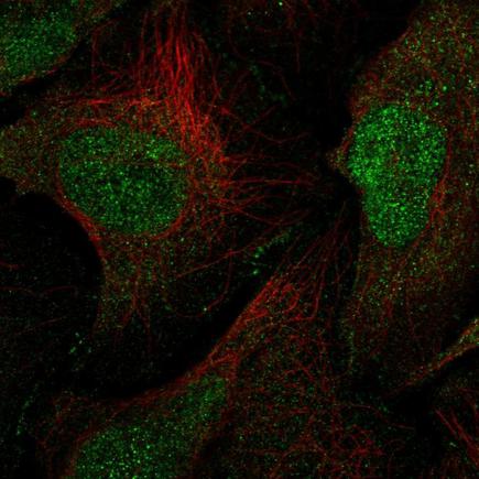 Immunocytochemistry/ Immunofluorescence - Anti-MAGI1 antibody (AB222082)