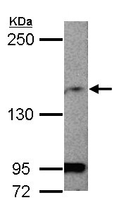 Western blot - Anti-MAGI1 antibody - C-terminal (AB155928), expandable thumbnail