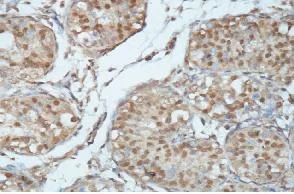 Immunohistochemistry (Formalin/PFA-fixed paraffin-embedded sections) - Anti-MAGI3 antibody (AB118615)