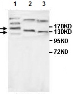 Western blot - Anti-MAGI3 antibody (AB118615), expandable thumbnail