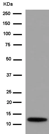 Western blot - Anti-MAGMAS antibody [EPR15214] - BSA and Azide free (AB250716)