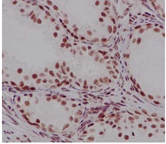 Immunohistochemistry (Formalin/PFA-fixed paraffin-embedded sections) - Anti-Mago nashi homolog 2 antibody [EPR14037-43] (AB186431)