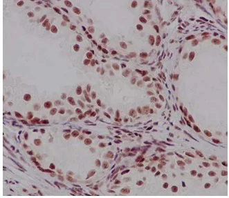 Immunohistochemistry (Formalin/PFA-fixed paraffin-embedded sections) - Anti-Mago nashi homolog 2 antibody [EPR14037-43] - BSA and Azide free (AB250884)