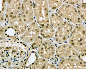 Immunohistochemistry (Formalin/PFA-fixed paraffin-embedded sections) - Anti-MAGOH antibody [EPR10745] (AB170944), expandable thumbnail