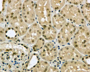 Immunohistochemistry (Formalin/PFA-fixed paraffin-embedded sections) - Anti-MAGOH antibody [EPR10745] (AB170944)