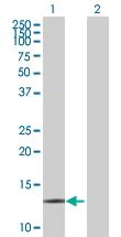 Western blot - MAGOH overexpression 293T lysate (whole cell) (AB94264)