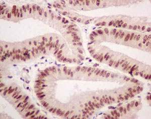 Immunohistochemistry (Formalin/PFA-fixed paraffin-embedded sections) - Anti-MAGOH+MAGOHB antibody [EPR14037] (AB180505), expandable thumbnail