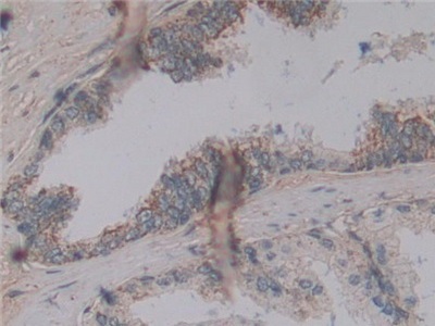 Immunohistochemistry (Formalin/PFA-fixed paraffin-embedded sections) - Anti-MAGP1 antibody (AB231344)