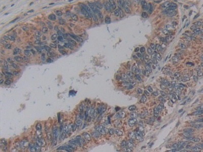 Immunohistochemistry (Formalin/PFA-fixed paraffin-embedded sections) - Anti-MAGP1 antibody (AB231344)